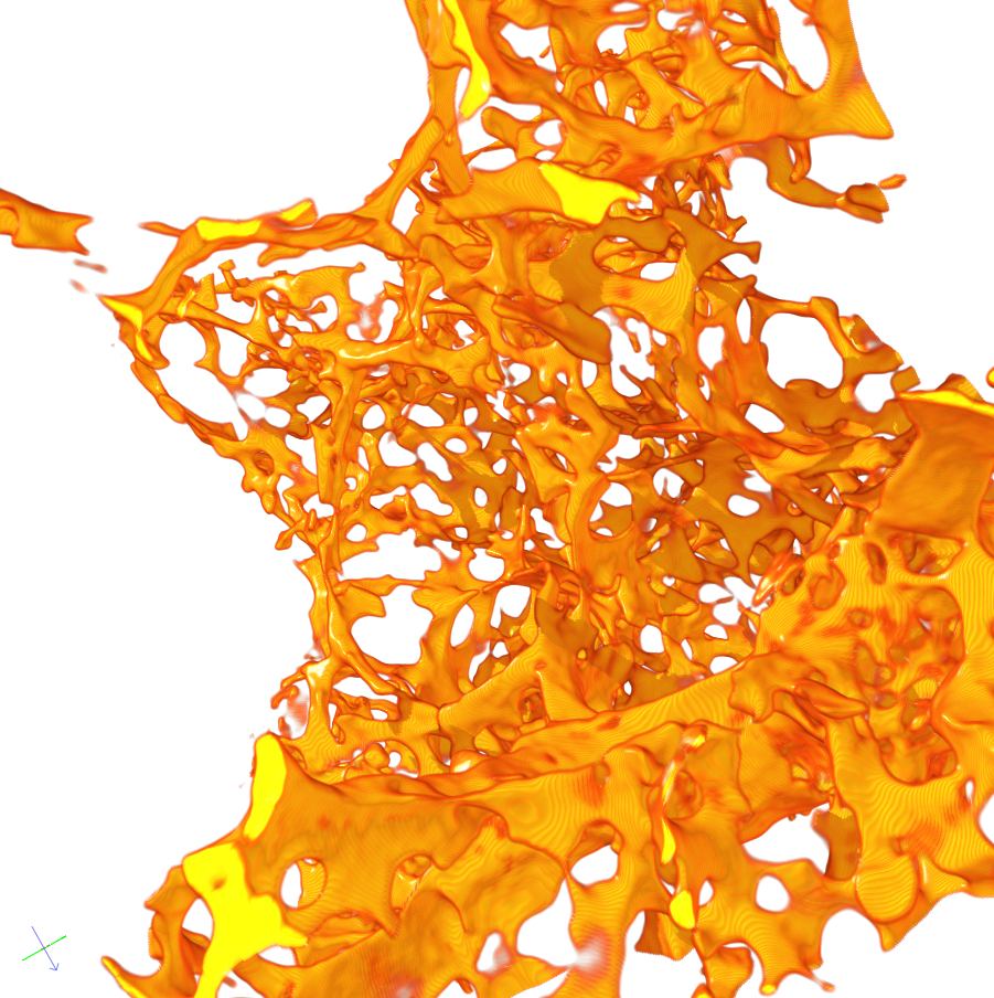 Excerpt of 3D reconstruction of intussusceptive pillars in Murine lung